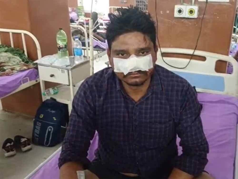 पारिवारिक विवाद बना हिंसा का रूप: बेटे ने पिता के प्राइवेट पार्ट और नाक पर दांत से काटा